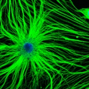 A bright green cells extends across a black background